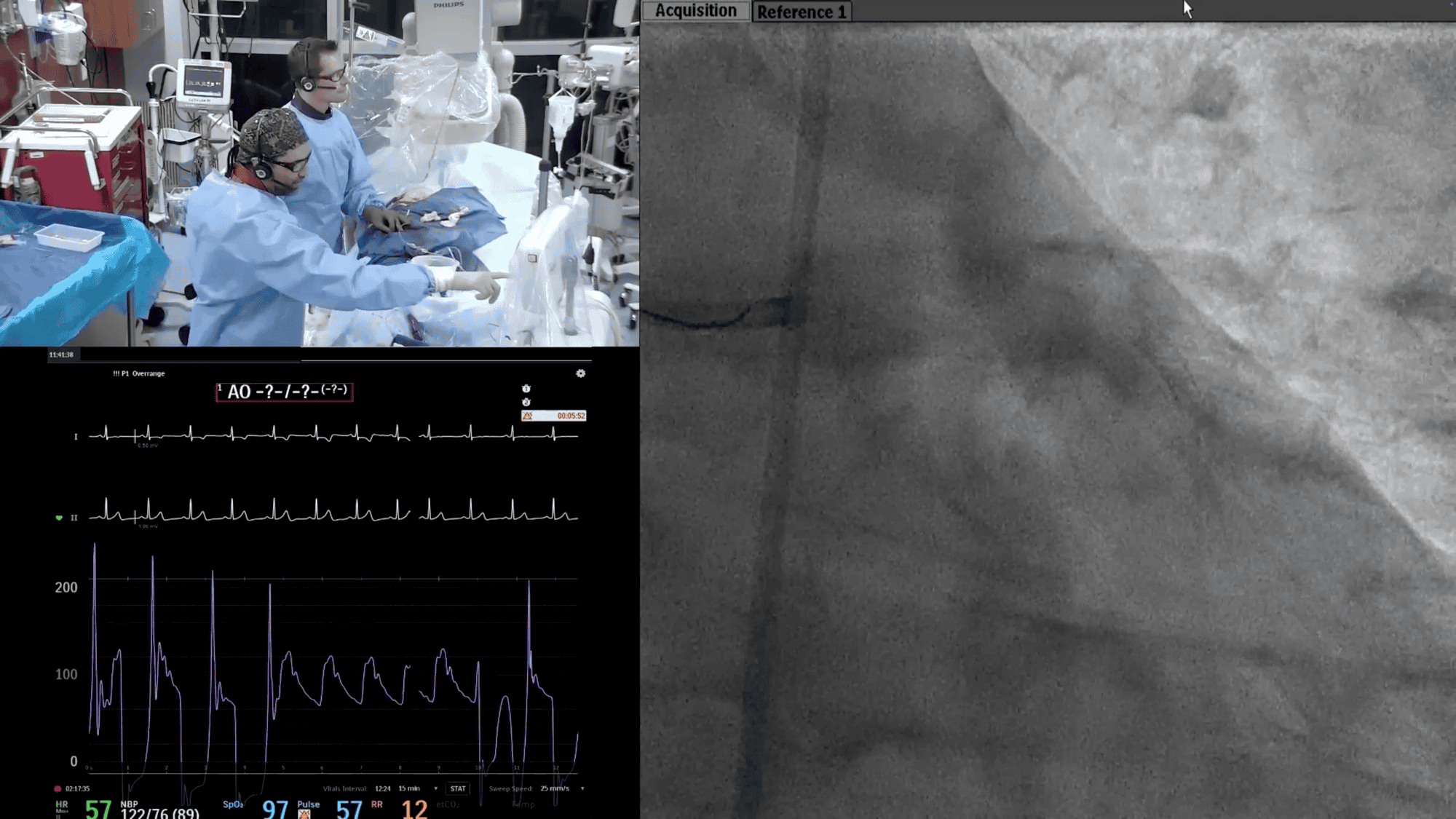 Screenshot from PCI Plan for the left-side video